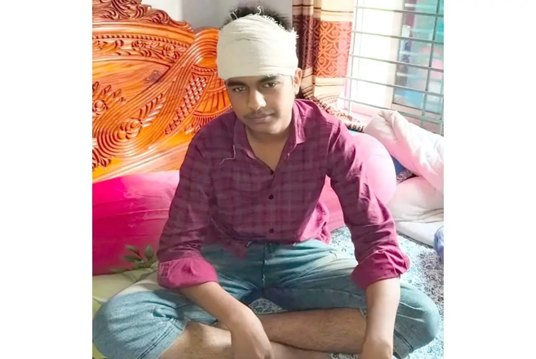 শেরপুরে চুরিতে বাধা দেওয়ায় কিশোরকে হাতুড়িপেটা