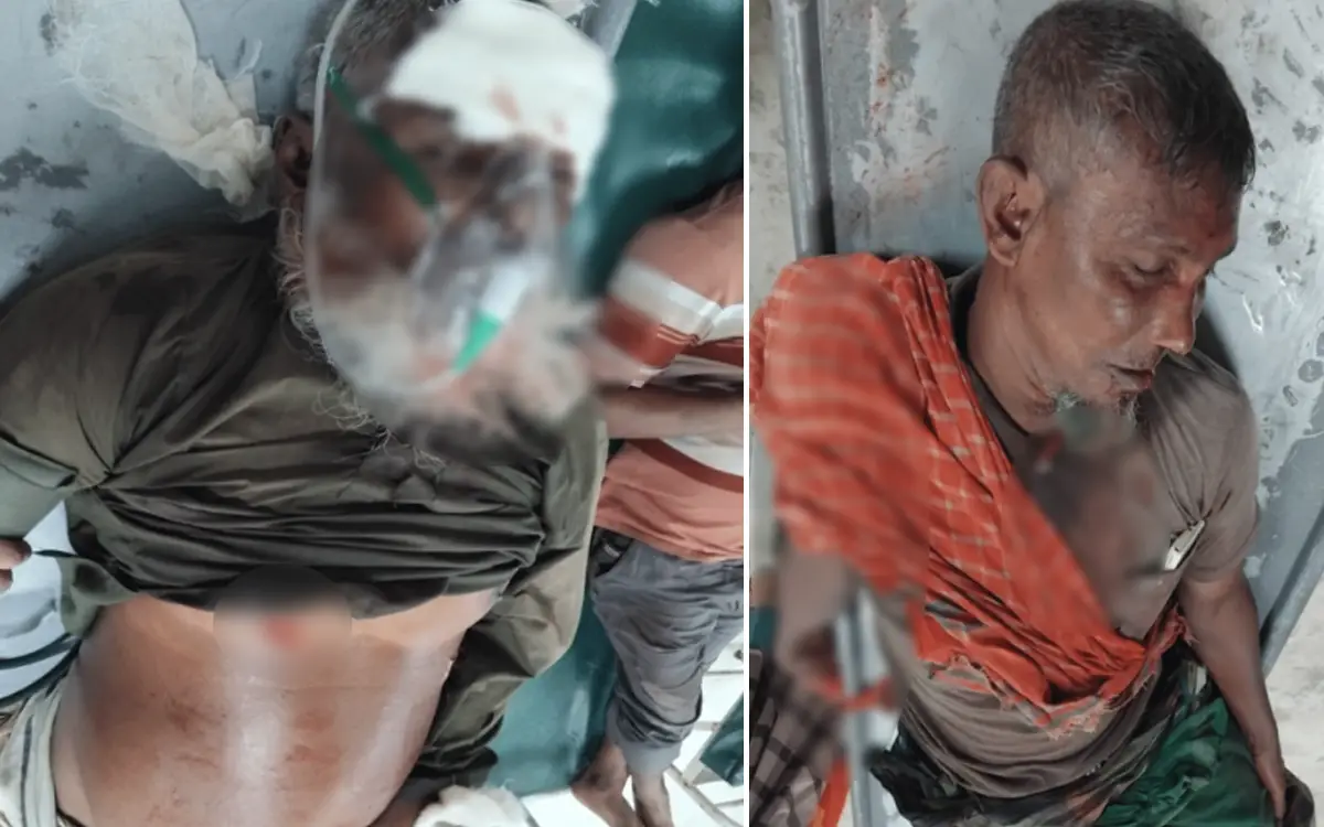 নন্দীগ্রামে মিনি ট্রাকের সঙ্গে ভটভটির সংঘর্ষ, হাসপাতালে দুই গরু ব্যবসায়ী