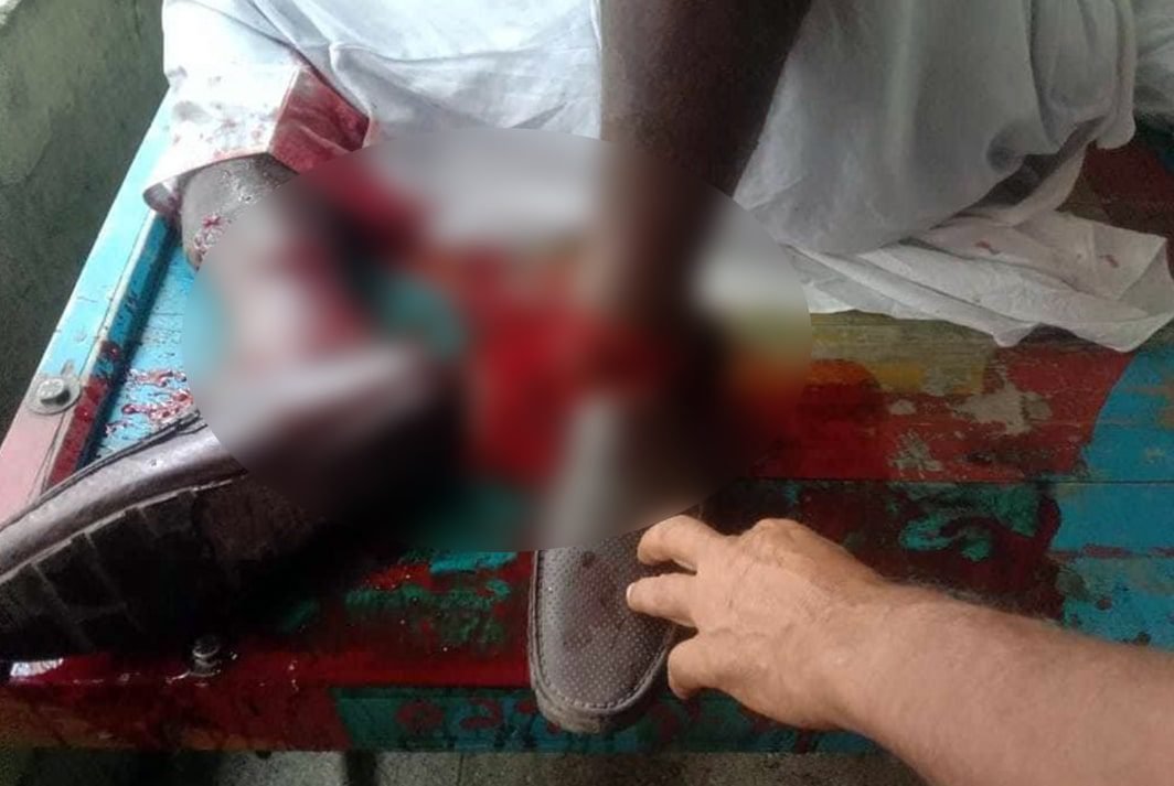 নওগাঁর আত্রাইয়ে স্কুল শিক্ষকের পায়ের রগ কেটে দিল দুর্বৃত্তরা