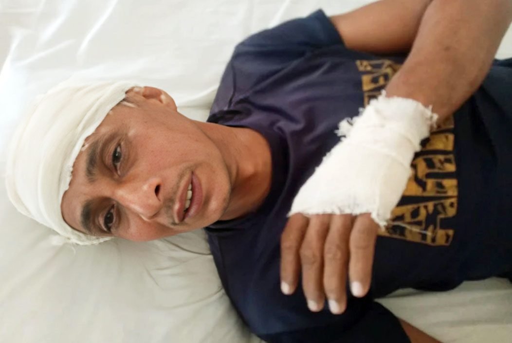 বরিশালের উজিরপুরে পাওনা টাকা চাইতে গিয়ে ছোট ভাইয়ের হামলায় আহত বড় ভাই