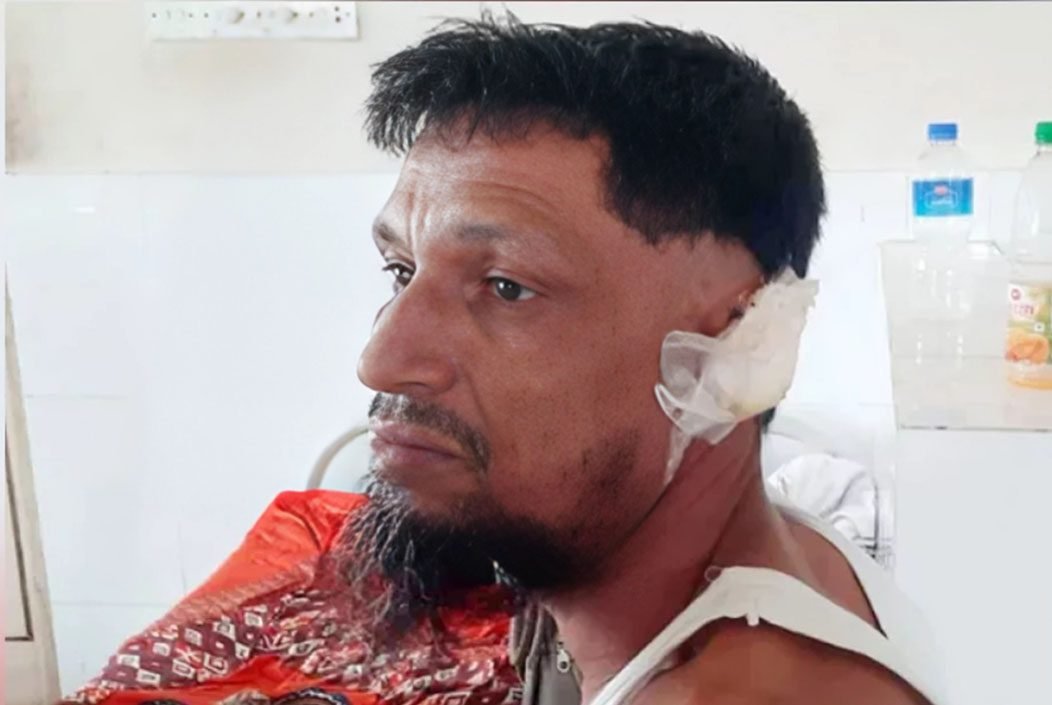 নেত্রকোণার মোহনগঞ্জে কামড় দিয়ে স্বামীর কান ছিঁড়ে নিলেন স্ত্রী