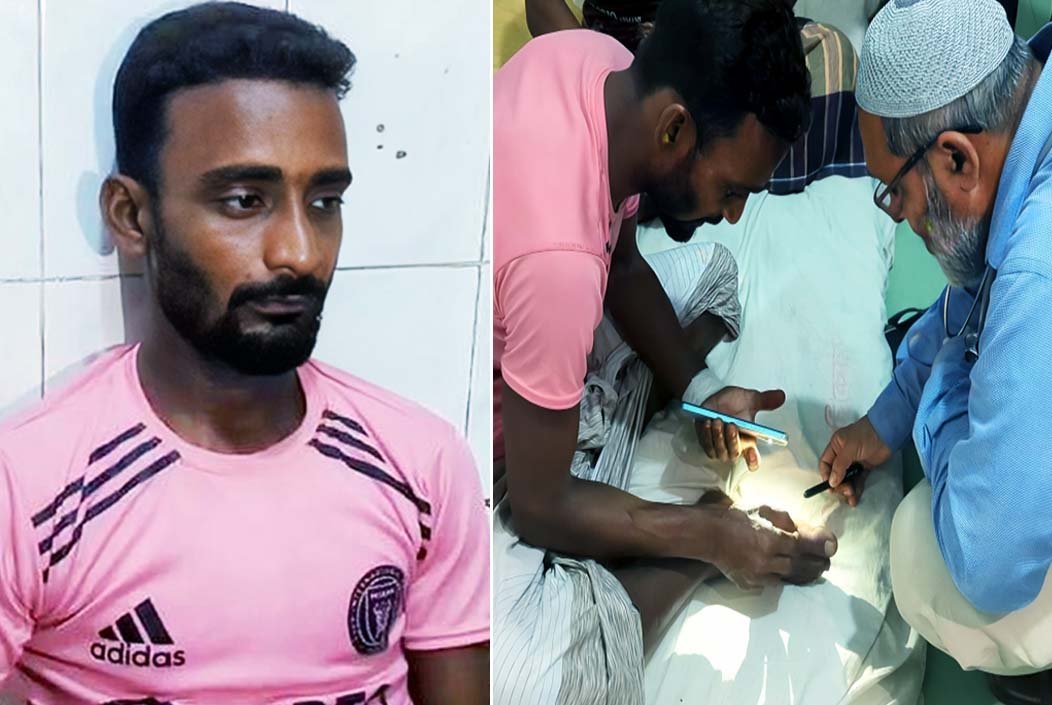 রাসেলস ভাইপার সাপকে লাথি, ছোবল খেয়ে হাসপাতালে যুবক