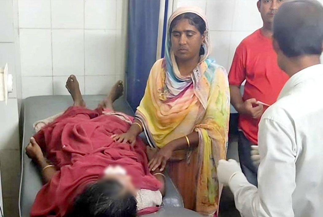 সরিষাবাড়ীতে শিয়ালের কামড়ে নারীসহ আহত ৭