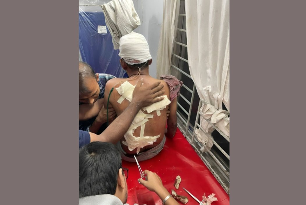 সাবেক সেতুমন্ত্রী ওবায়দুল কাদেরের ভগ্নিপতিকে কুপিয়ে জখম