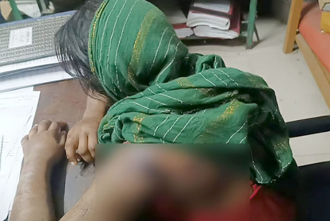 কিশোরী ভাগনিকে গরম খুন্তির ছেঁকা-নির্যাতন, মামা-মামি গ্রেফতার