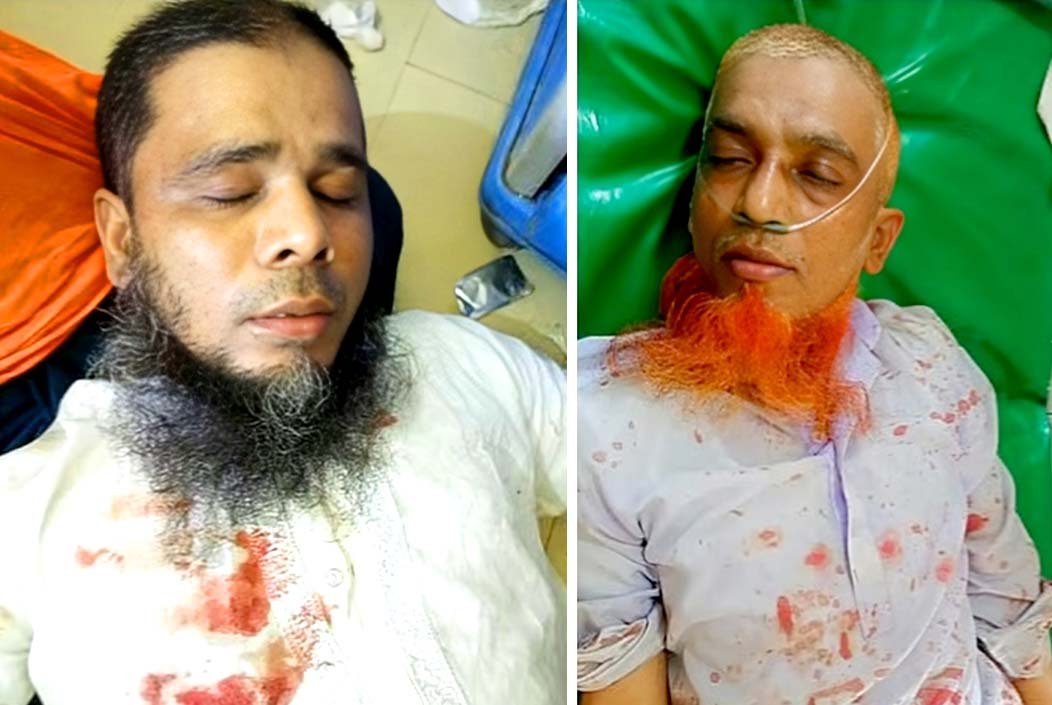জমি বিরোধের জেরে দুই সহোদরের ওপর নৃশংস হামলা