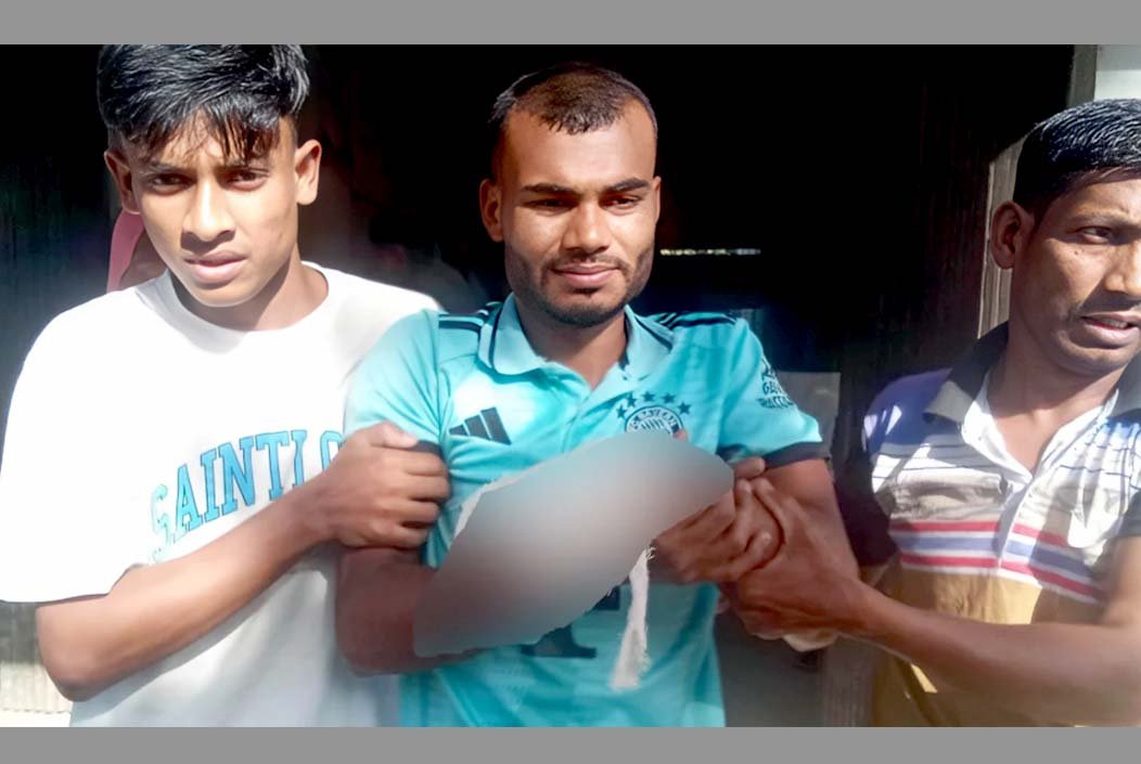 বোমা তৈরির সময় বিস্ফোরণে কলেজ ছাত্রের হাত বিচ্ছিন্ন, গ্রেফতার ৩