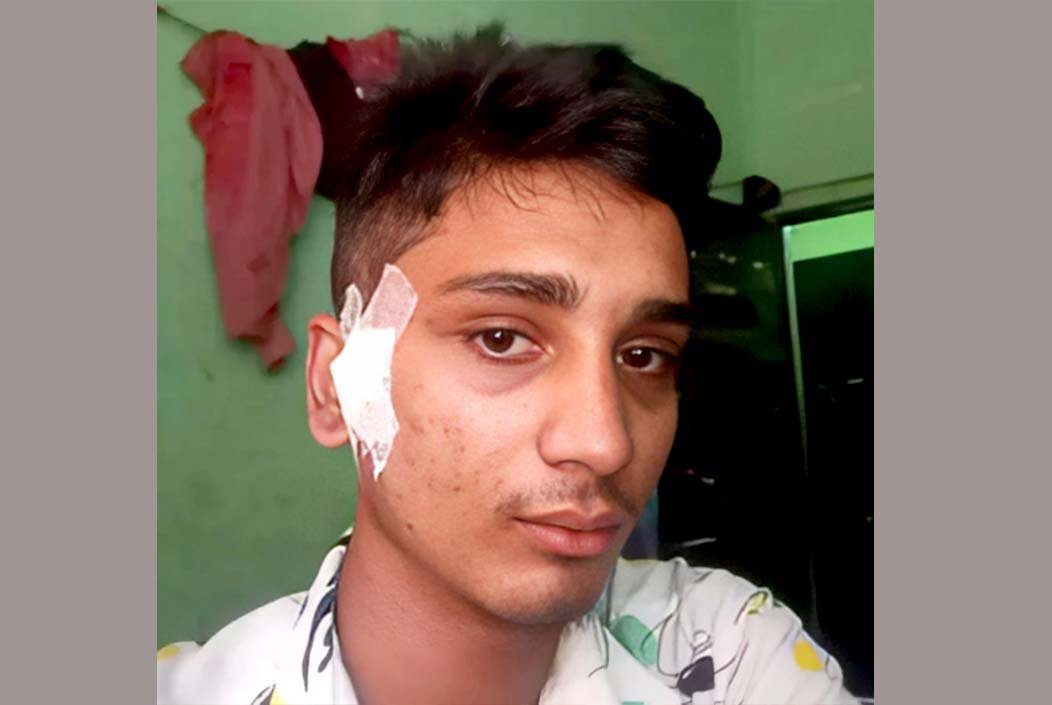 রিকশা-গরু বিক্রি করেও বাঁচানো গেল না ‘জুলাই যোদ্ধা’ হৃদয়কে