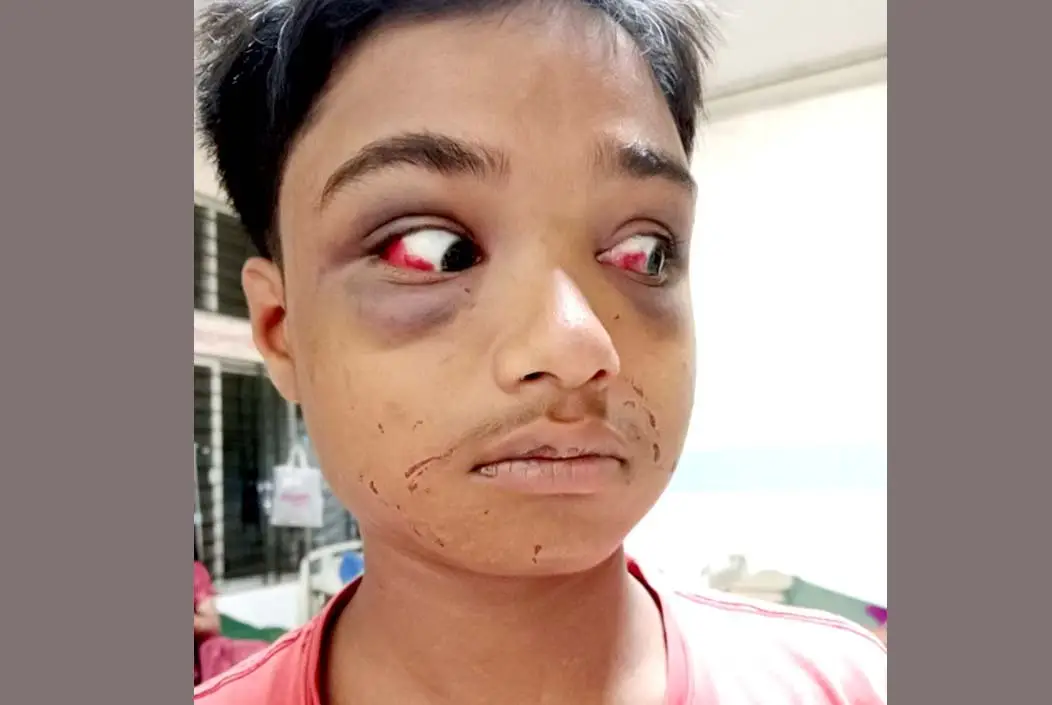 চুরির অভিযোগে হাত-পা বেঁধে শিশুকে নির্যাতন, বয়স বাড়িয়ে দেওয়া হয় মামলা