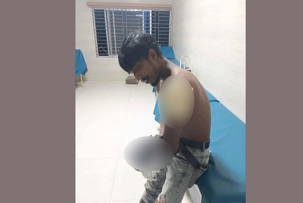 বগুড়ায় দুই বন্ধুর একে অপরকে ছুরিকাঘাত