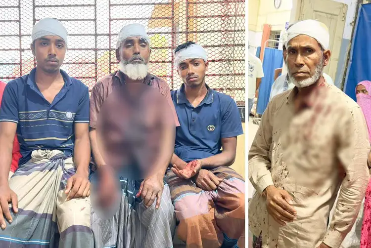 শেরপুরে জমি নিয়ে বিরোধে রক্তক্ষয়ী সংঘর্ষ, নারীসহ আহত ১১