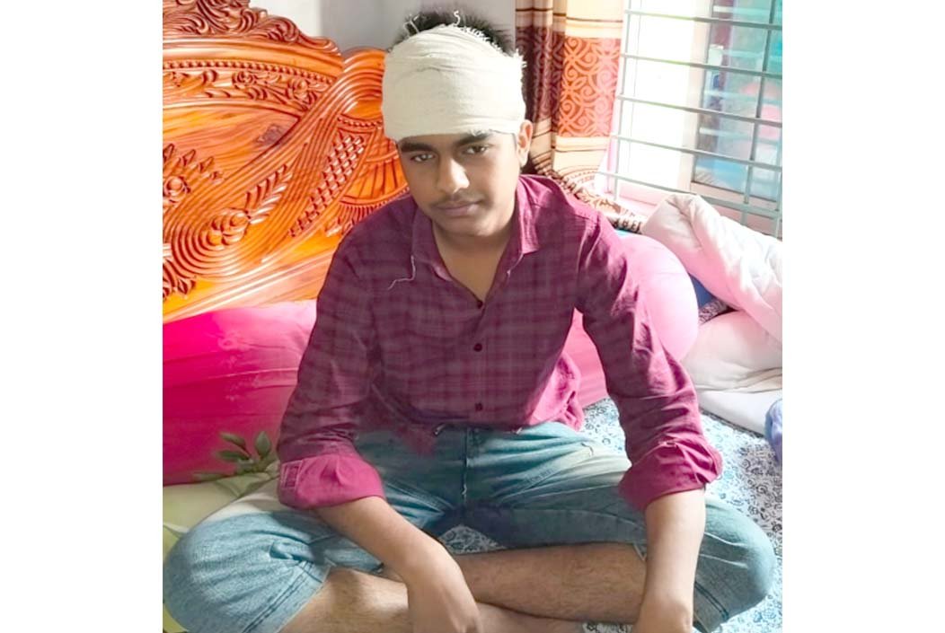 শেরপুরে চুরিতে বাধা দেওয়ায় কিশোরকে হাতুড়িপেটা