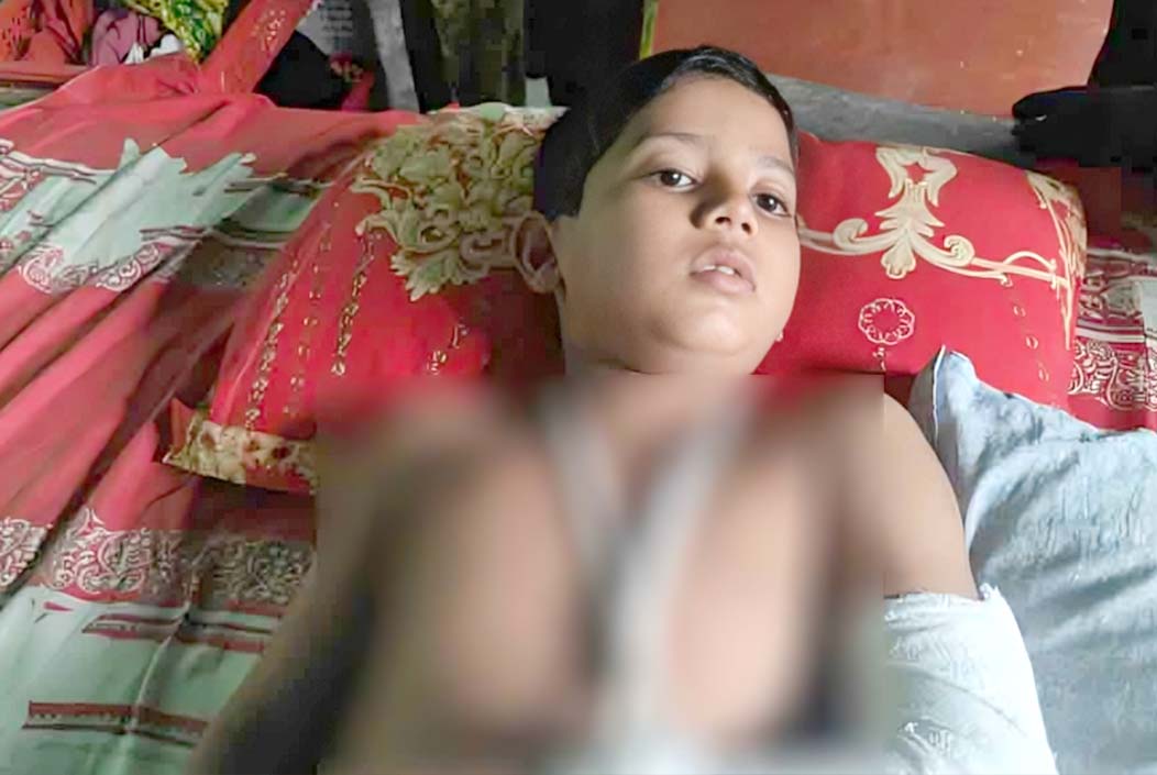 বেত্রাঘাতে হাত ভাঙল মাদরাসাছাত্রের