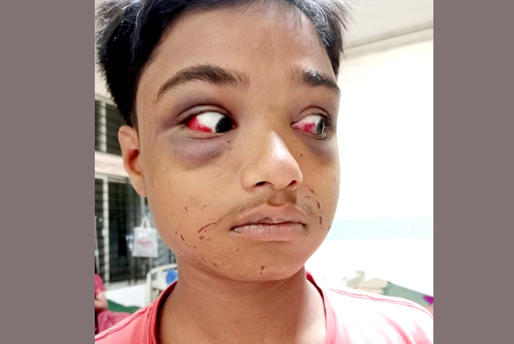 চুরির অভিযোগে হাত-পা বেঁধে শিশুকে নির্যাতন, বয়স বাড়িয়ে দেওয়া হয় মামলা