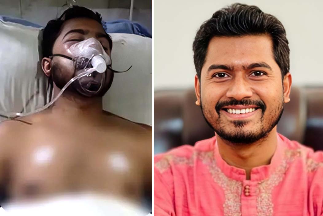 Nurul Haque suffered head injury, broken nose DMCH director Onnetion
