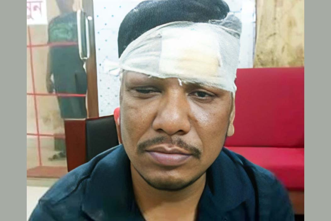 বরিশালের আগৈলঝাড়ায় গরু চুরি করে পালিয়ে যাওয়ার সময় আটক বরিশালের আগৈলঝাড়ায় গরু চুরি করে পালিয়ে যাওয়ার সময় আটক