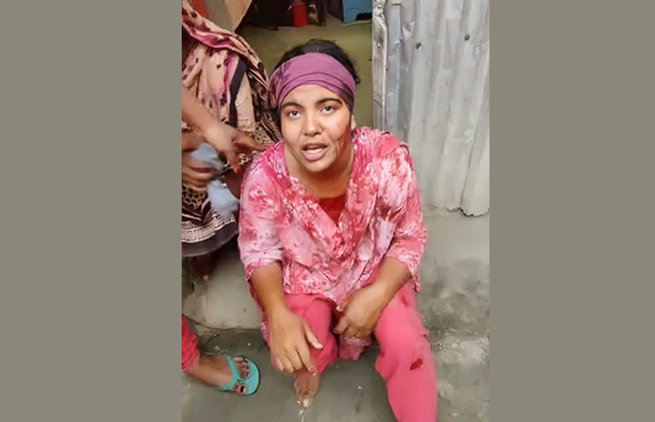 কিস্তি দিতে না পারায় নারী গ্রাহকের মাথায় কোপ দিল এনজিওকর্মী কিস্তি দিতে না পারায় নারী গ্রাহকের মাথায় কোপ দিল এনজিওকর্মী