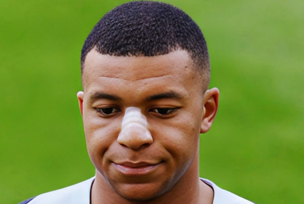 নাকে প্লাস্টার লাগিয়ে অনুশীলনে ফিরলেন এমবাপে নাকে প্লাস্টার লাগিয়ে অনুশীলনে ফিরলেন এমবাপে