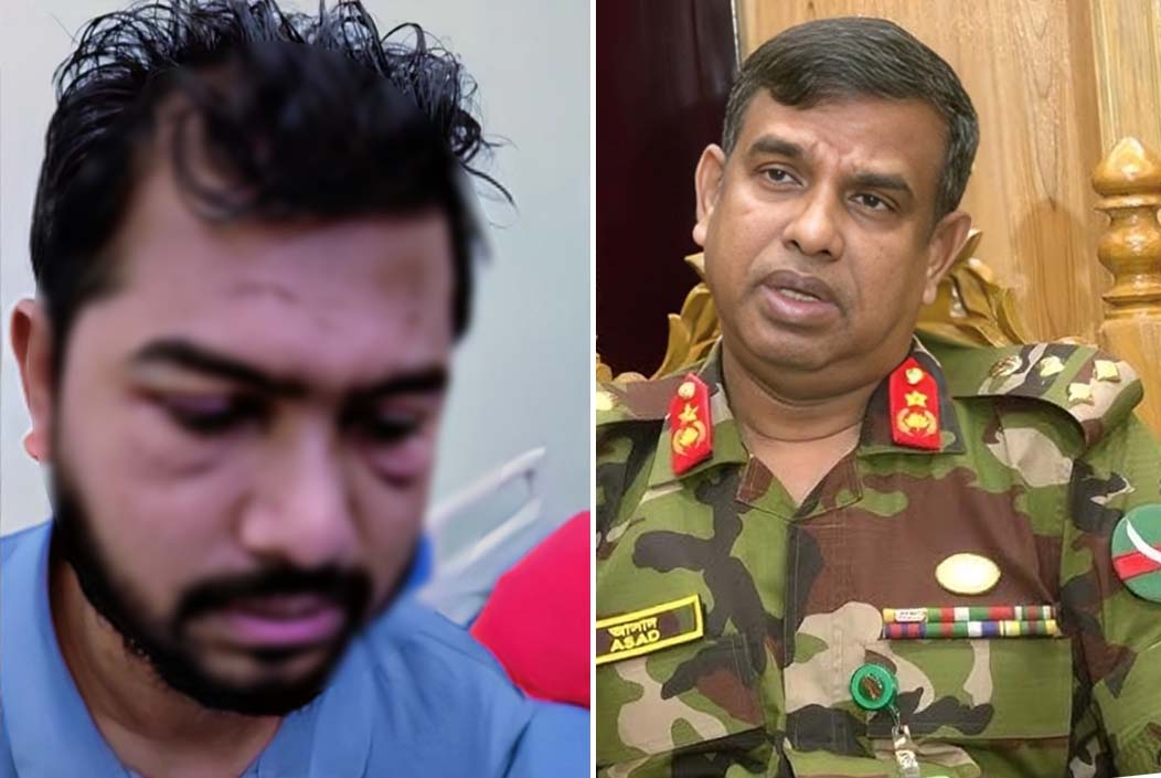 নুরের মেমোরি লস হওয়ার শঙ্কা নেই: ঢামেক পরিচালক Noor not at risk of memory loss DMCH director Onnetion
