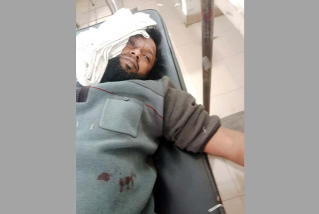 Jubo Dal leader stabbed over dispute in Bogra Onnetion