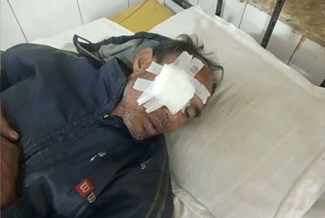 জমি বিরোধে ফসলে আগুন, হামলায় দৃষ্টিশক্তি হারালেন কৃষক loses eyesight in attack on crops over land dispute Onnetion