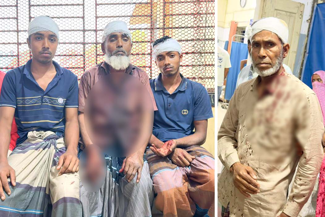 শেরপুরে জমি নিয়ে বিরোধে রক্তক্ষয়ী সংঘর্ষ, নারীসহ আহত ১১ Bloody clash over land dispute in Sherpur, 11 injured, including woman Onnetion